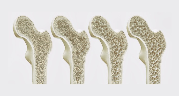 Illustrative image of bone structure representing bone health