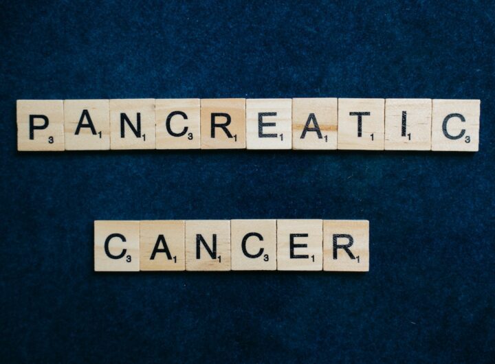 Pancreatic Cancer Research Advances 2023