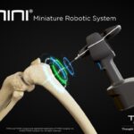 THINK Surgical TMINI Miniature Robotic System
